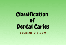 Classification of Dental Caries