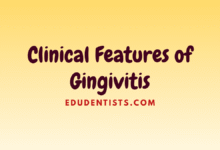 Clinical Features of Gingivitis