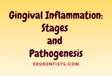 Gingival Inflammation Stages and Pathogenesis