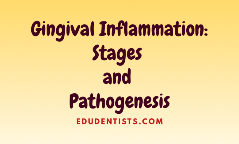 Gingival Inflammation Stages and Pathogenesis