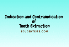 Indication and Contraindication of Tooth Extraction