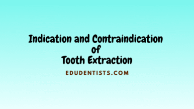 Indication and Contraindication of Tooth Extraction