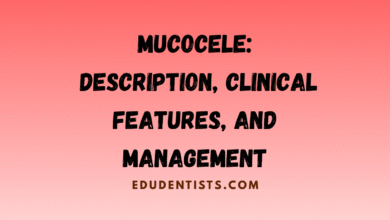 Mucocele Description, Clinical Features, and Management