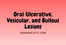 Oral Ulcerative, Vesicular, and Bullous Lesions