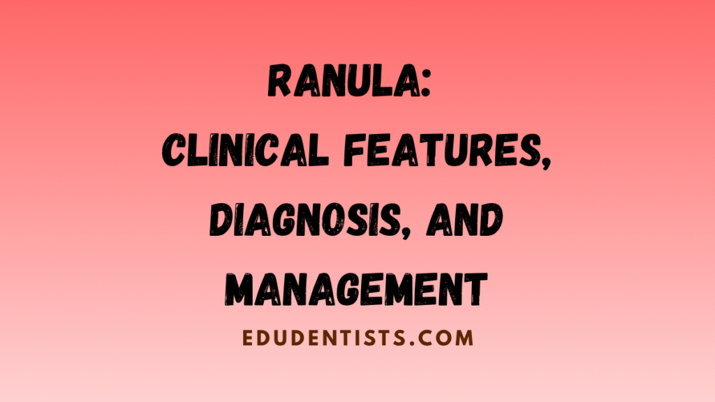 Ranula Clinical Features, Diagnosis, and Management