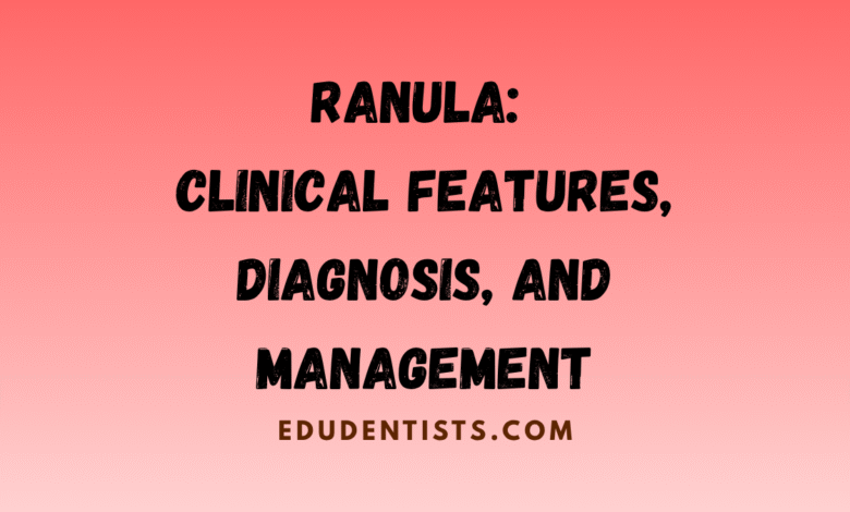 Ranula Clinical Features, Diagnosis, and Management
