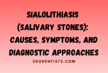Sialolithiasis (Salivary Stones) Causes, Symptoms, and Diagnostic Approaches