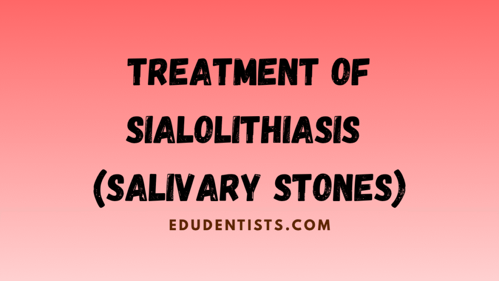 Treatment of Sialolithiasis (Salivary Stones)
