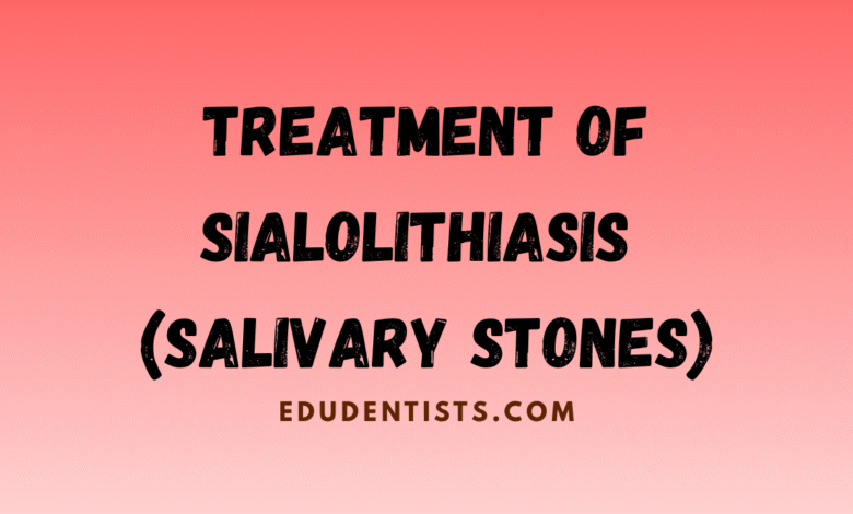 Treatment of Sialolithiasis (Salivary Stones)