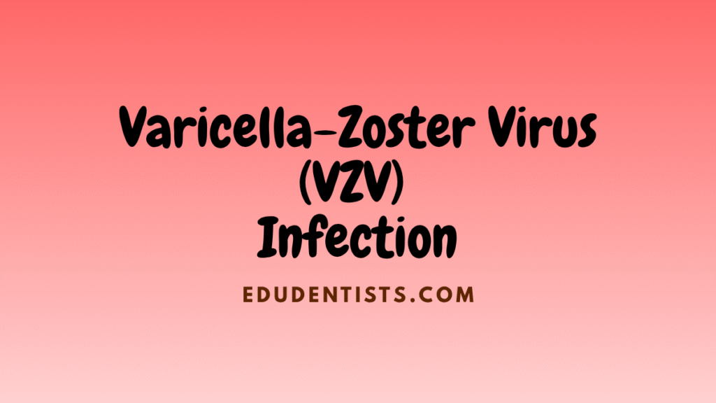 Varicella-Zoster Virus (VZV) Infection
