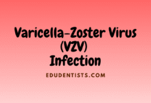 Varicella-Zoster Virus (VZV) Infection