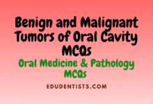 Benign and Malignant Tumors of Oral Cavity MCQs