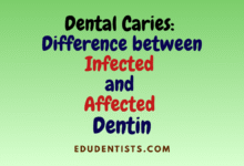 Dental Caries Difference between Infected and Affected Dentin