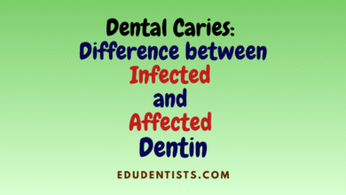 Dental Caries Difference between Infected and Affected Dentin