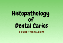 Histopathology of Dental Caries
