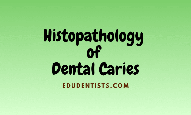 Histopathology of Dental Caries