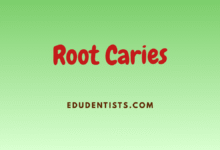 Root Caries Overview and Management