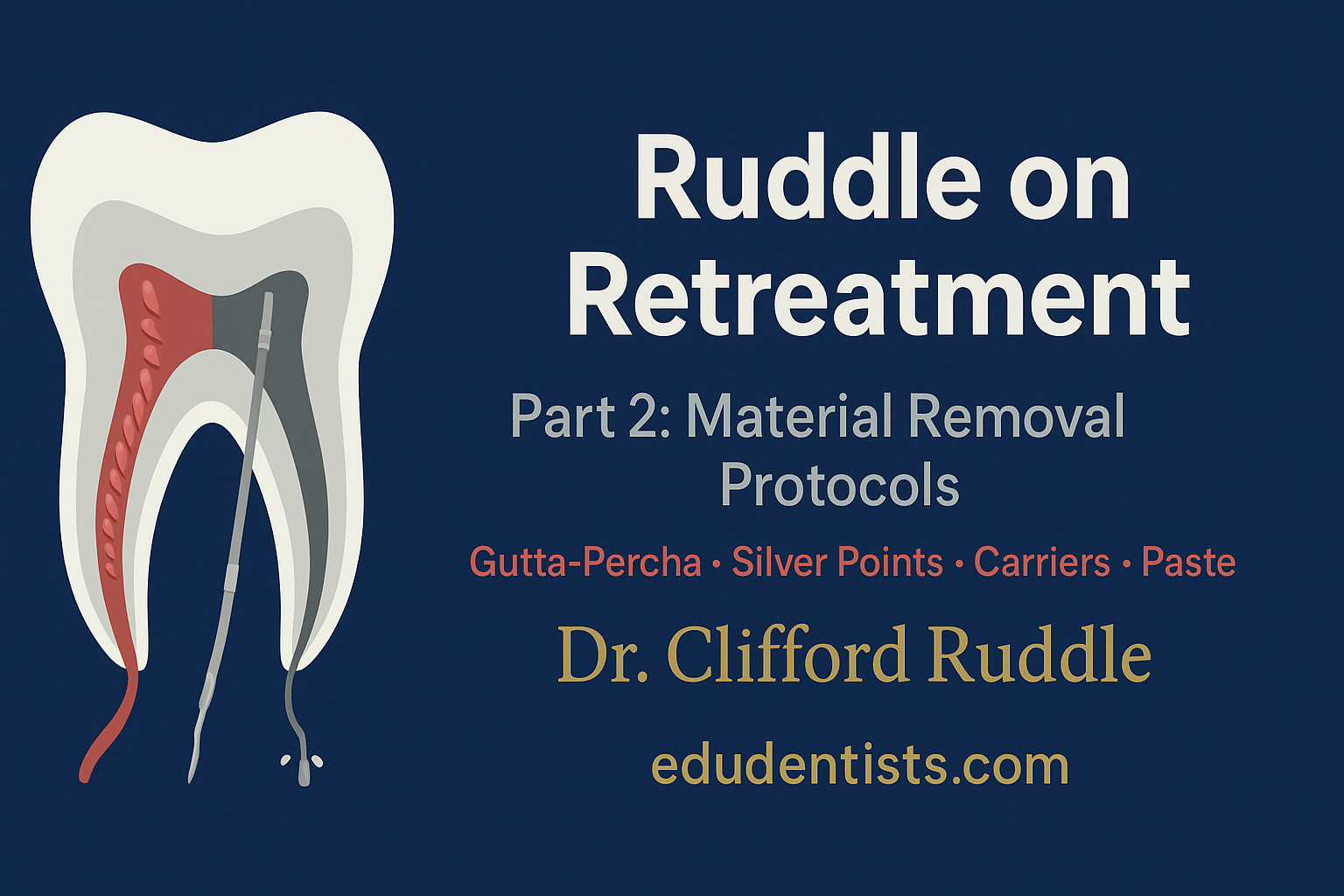 Ruddle on Retreatment – Part 2 Protocols for Gutta-Percha, Silver Point, Carrier, and Paste Removal