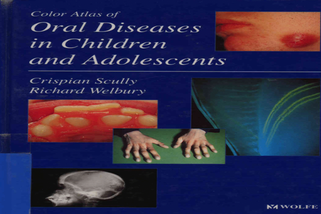 Color Atlas of Oral Diseases in Children and Adolescents