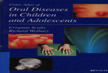 Color Atlas of Oral Diseases in Children and Adolescents