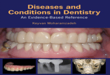 Diseases and Conditions in Dentistry Evidence-Based Reference – Free PDF