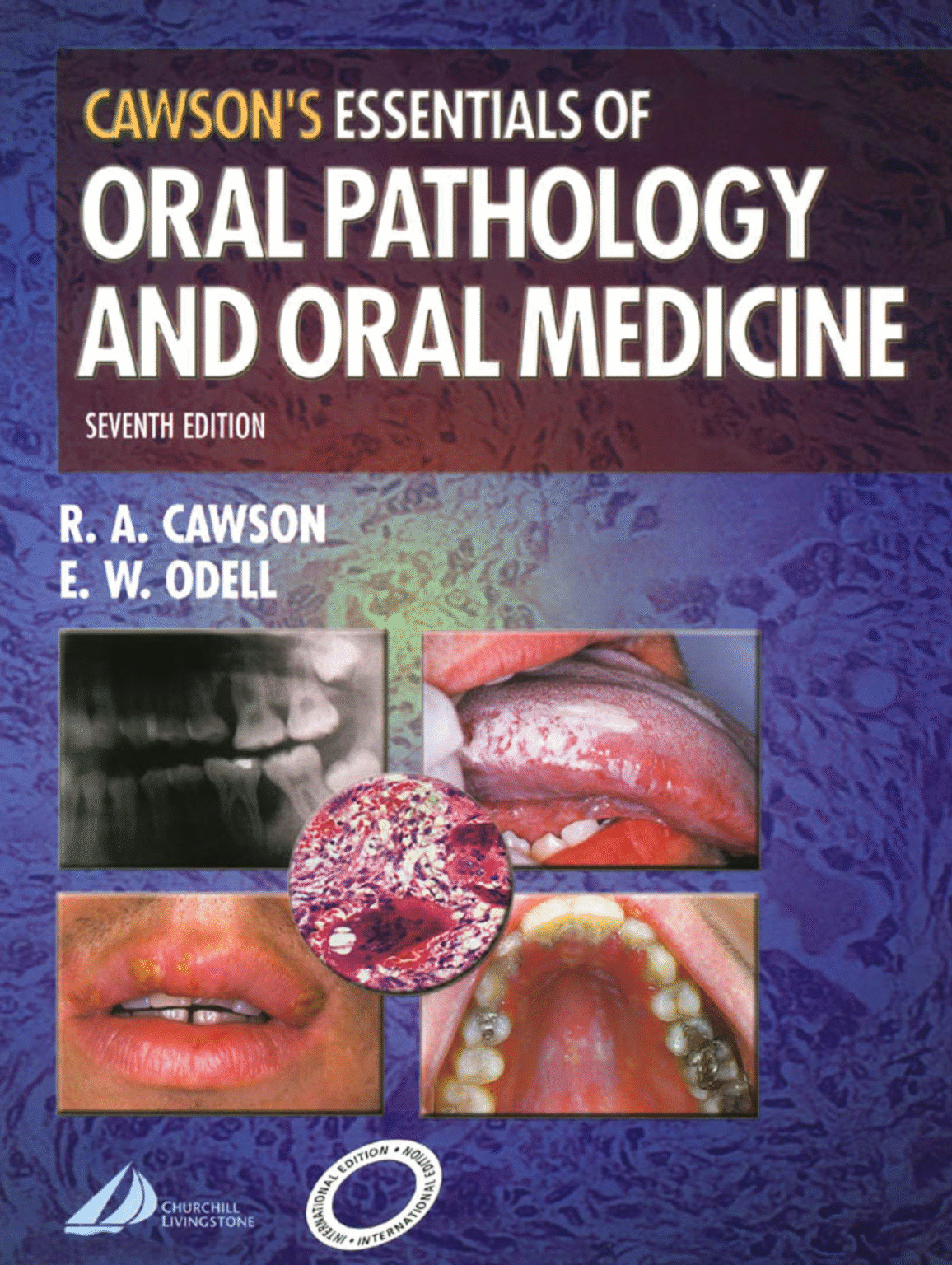 CAWSON'S ESSENTIALS OF ORAL PATHOLOGY AND ORAL MEDICINE – Free PDF ...